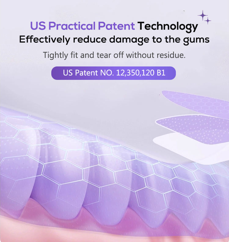 Glorysmile V34 Teeth Whitening Strips - Purple Correction Technology with PAP+