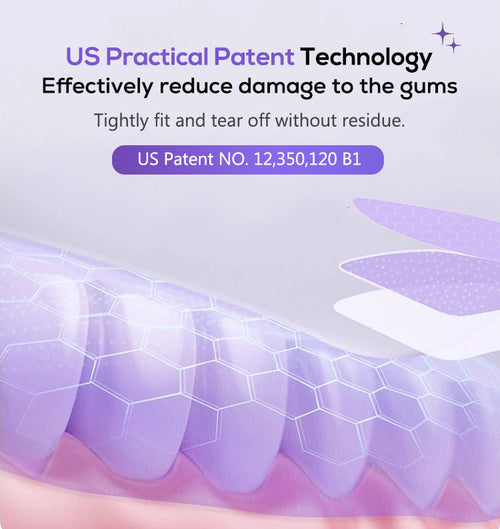 Glorysmile V34 Teeth Whitening Strips - Purple Correction Technology with PAP+
